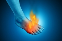 Erythromelalgia and Its Impact on the Feet