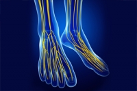 Tarsal Tunnel Syndrome Causes